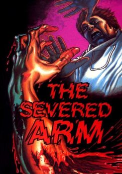 The Severed Arm