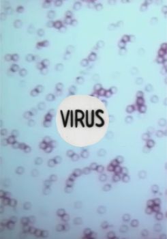 Virus