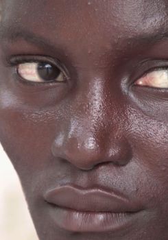 Guinée-Bissau - Les reines de l'Orango