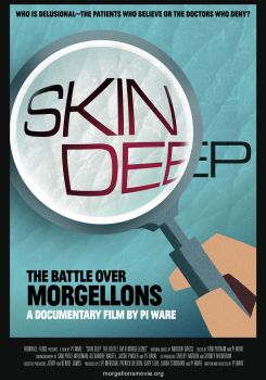 Skin Deep: The Battle Over Morgellons