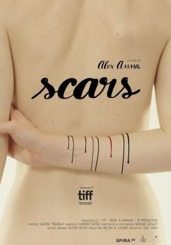 Scars