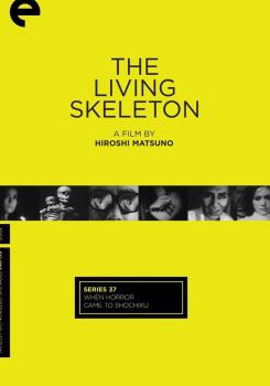 Living Skeleton